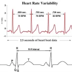 mejora-el-rendimiento-con-herramientas-practicas-para-evaluar-la-variabilidad-de-la-frecuencia-cardiaca